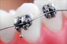 igel orthodontics