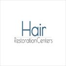 affordable hair transplants minneapolis