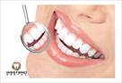 affordable dental implants