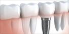 dentist |orthodontist |chapel gate dental