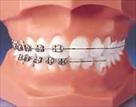 exeter orthodontics