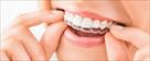 braces orthodontics pediatrics  bop braces