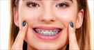 braces orthodontics pediatrics  bop braces