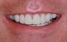 cosmetic dentistry dentist scottsdale