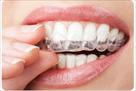 significance orthodontics