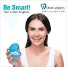 clear aligners india